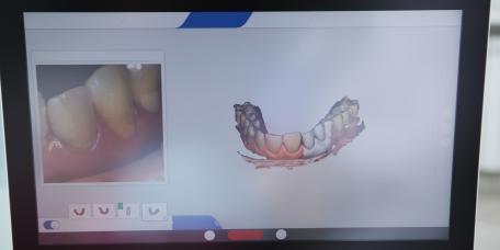 3D-Modell eines unterkiefers